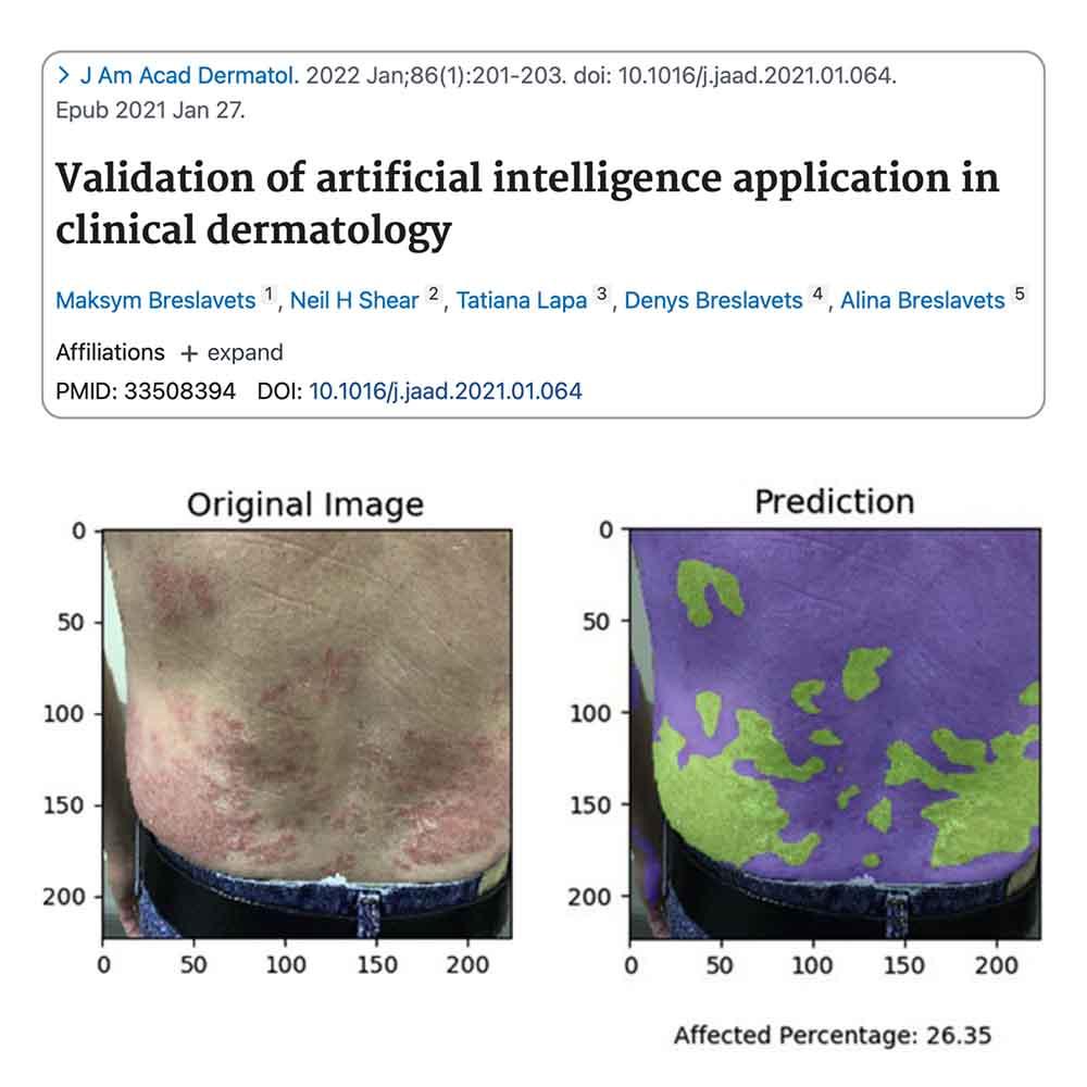 Validation of Artificial Intelligence Application in Clinical Dermatology