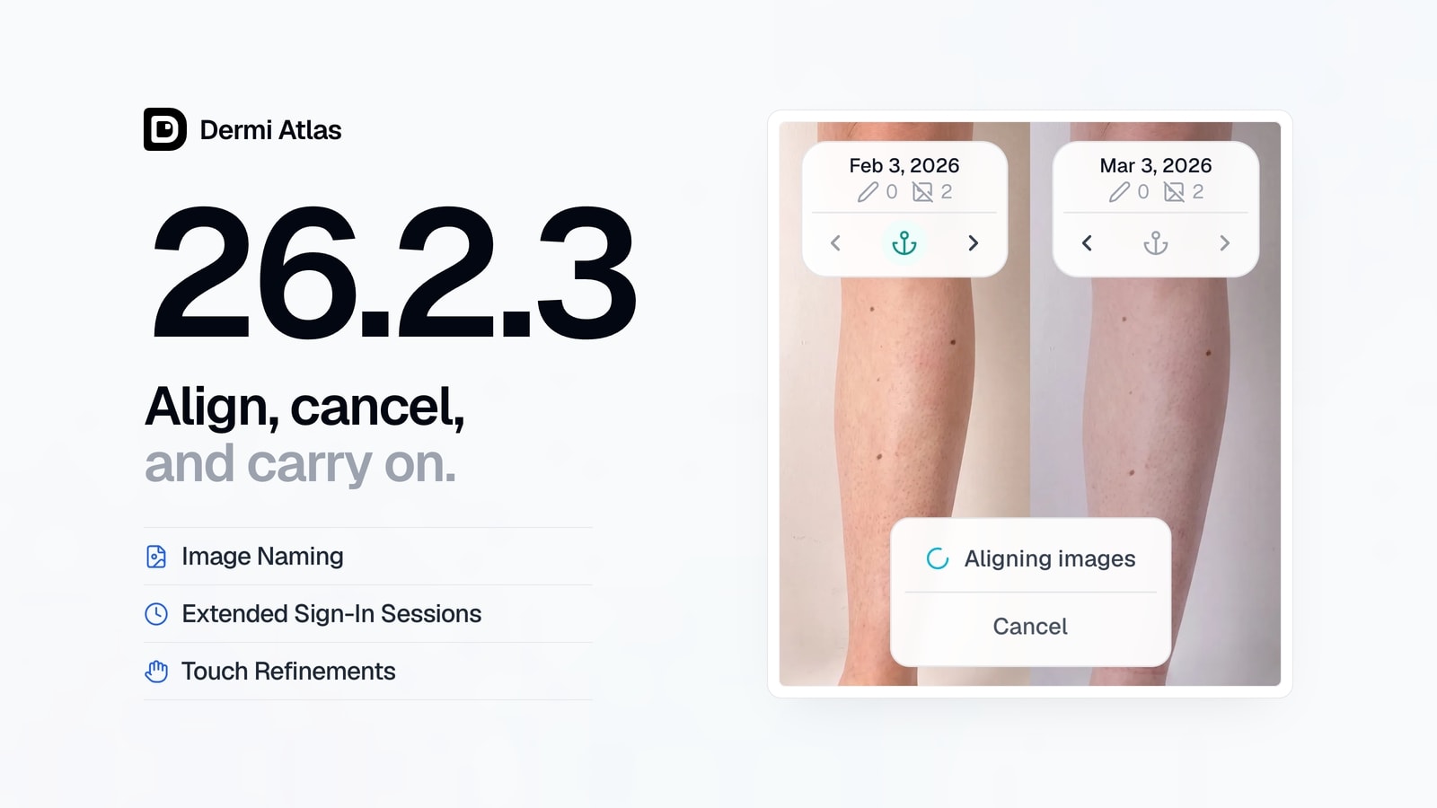 Two visits of the same shin side by side in Split mode, each labeled with its date, with the Aligning images indicator and its Cancel button