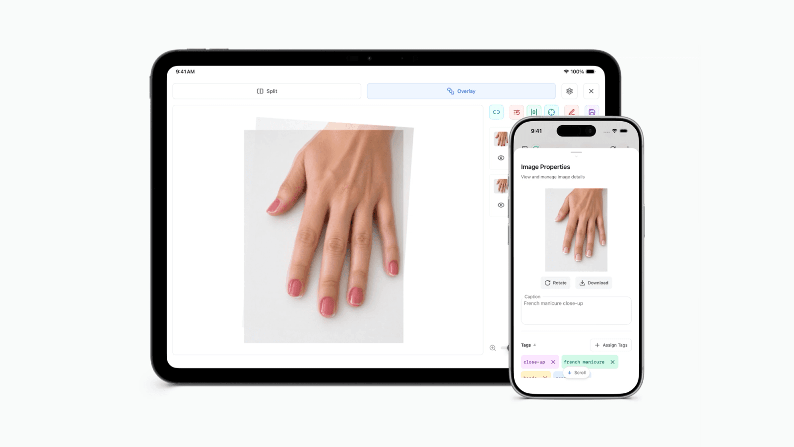 Dermi Atlas Companion clinical photography app shown on iPhone and iPad