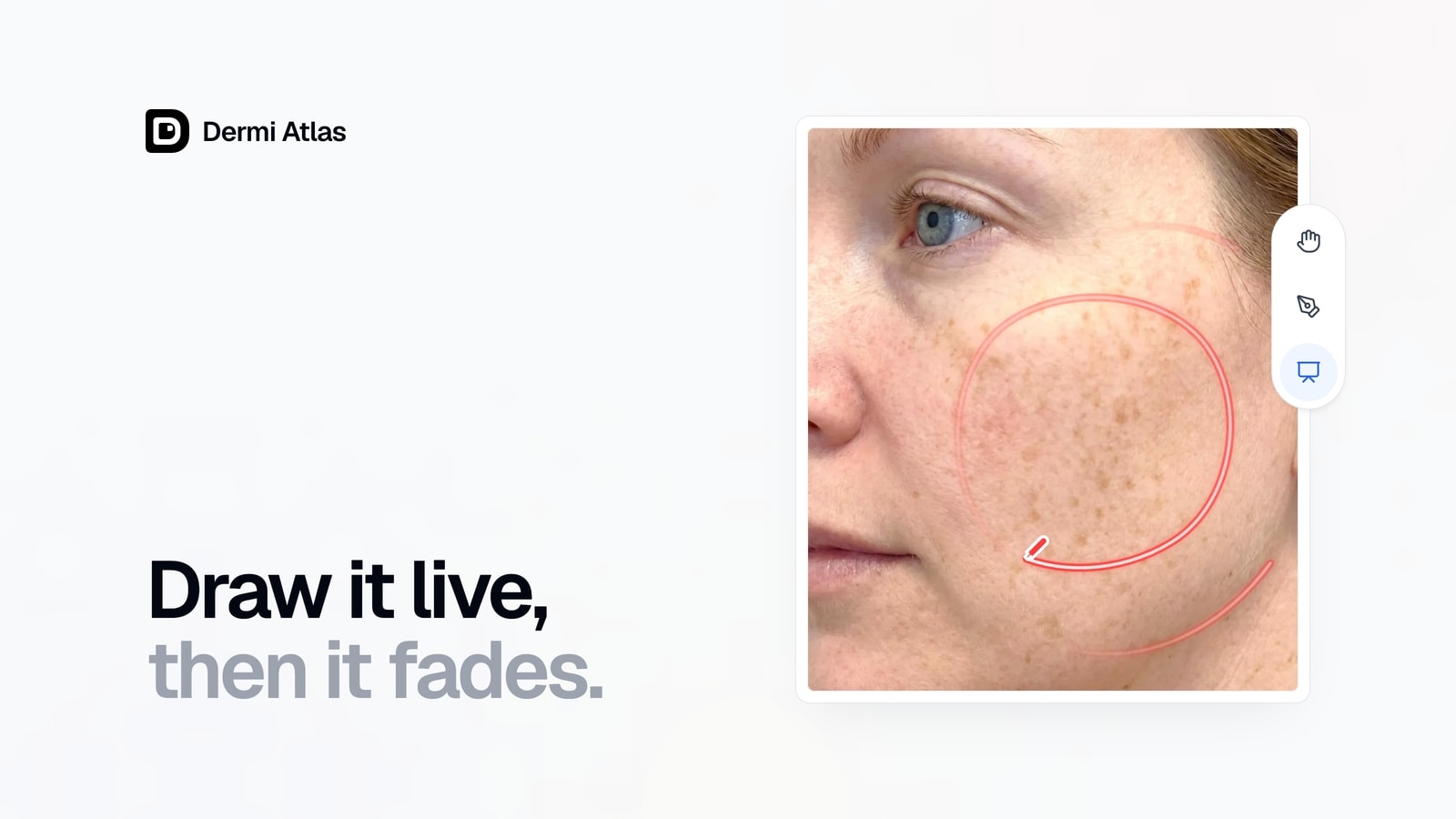 A cheek close-up with a glowing Live Pointer stroke circling the freckled skin as earlier strokes fade