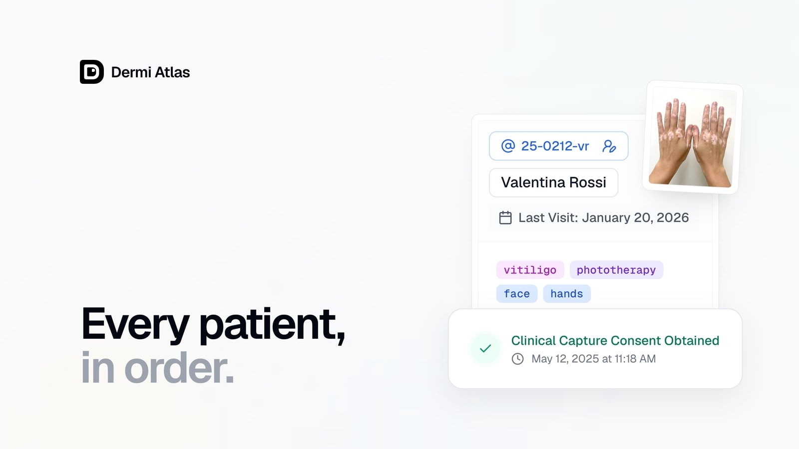 A patient record card with tags, a hand photograph, and a consent card