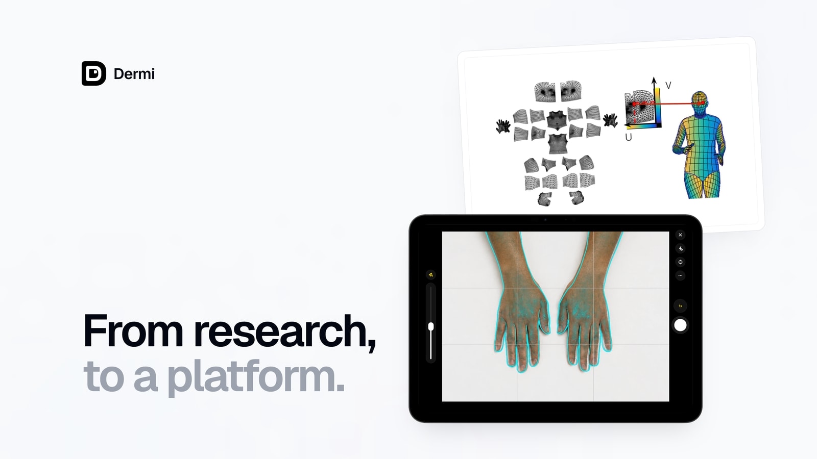 A research figure mapping the surface of a body, above Dermi Atlas Companion on iPad capturing hands with the previous visit as an alignment guide