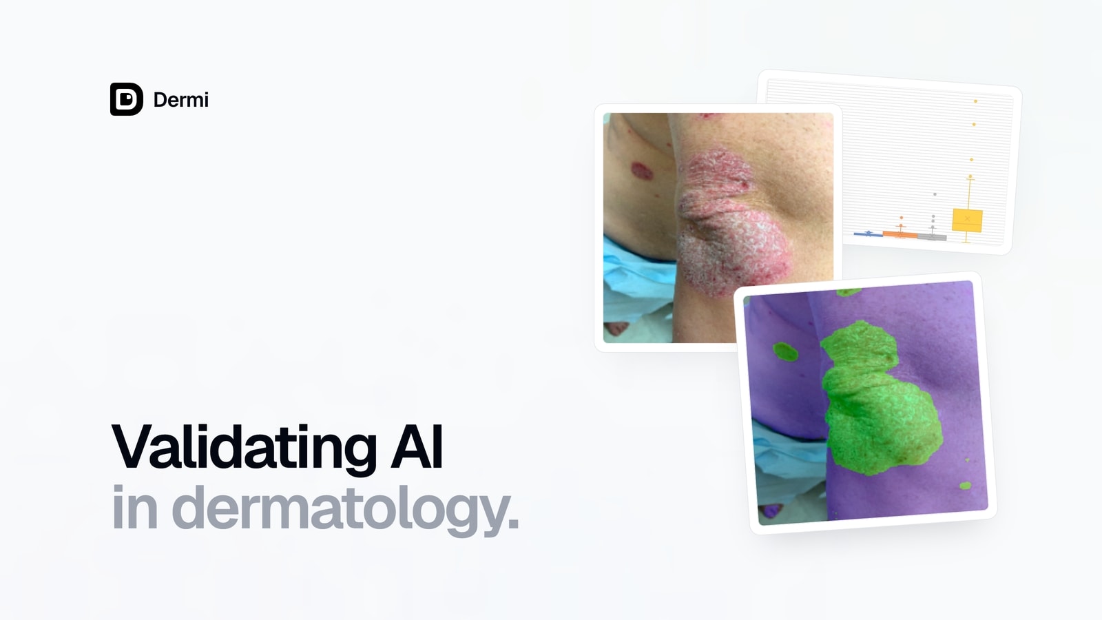 A psoriasis photograph beside its neural network segmentation, in front of a box plot from the validation study