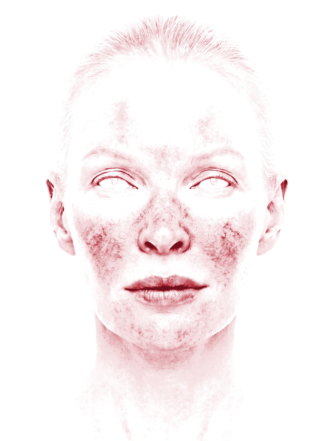 Before photograph, Erythema filter