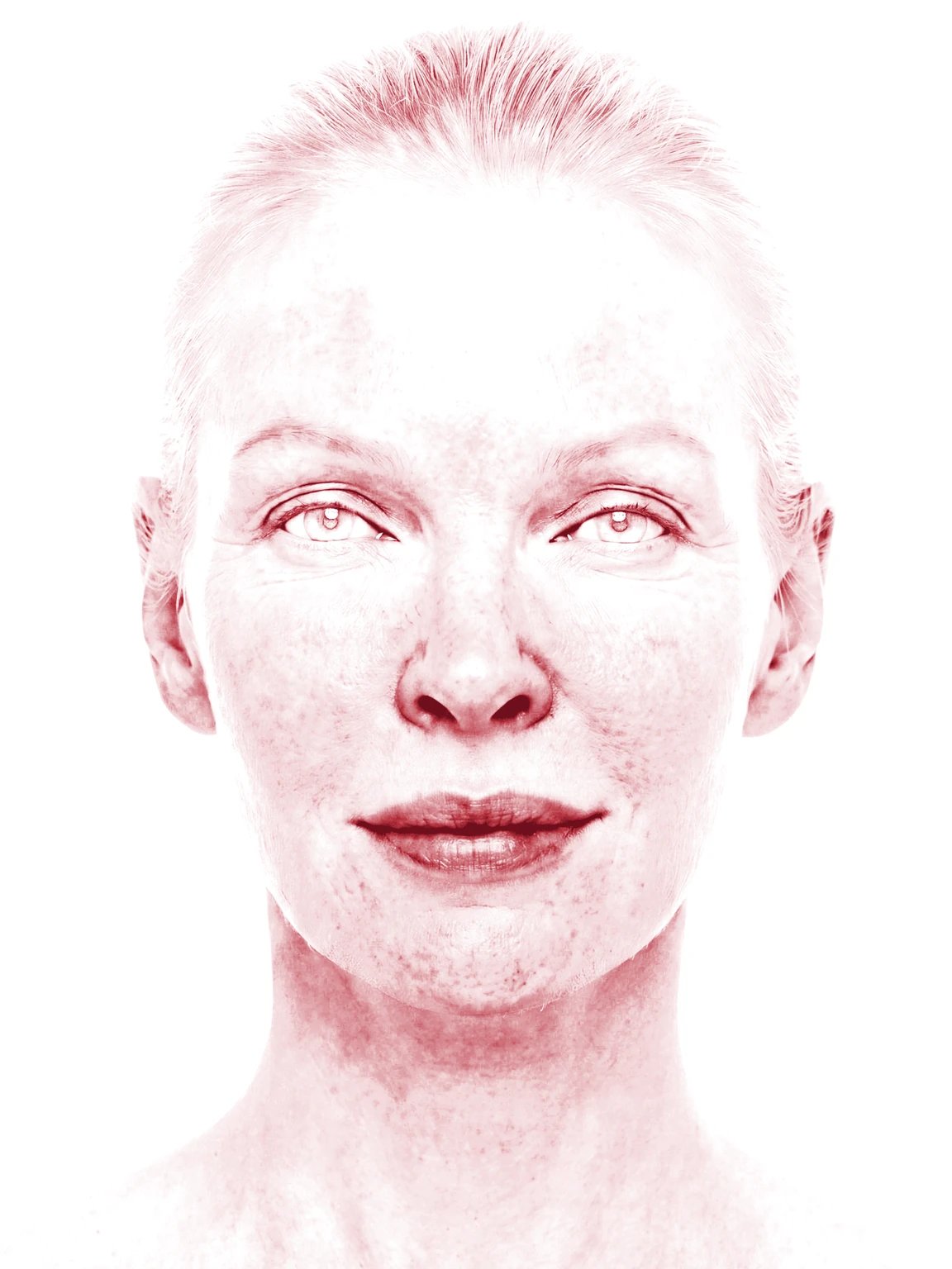 After photograph, Erythema filter