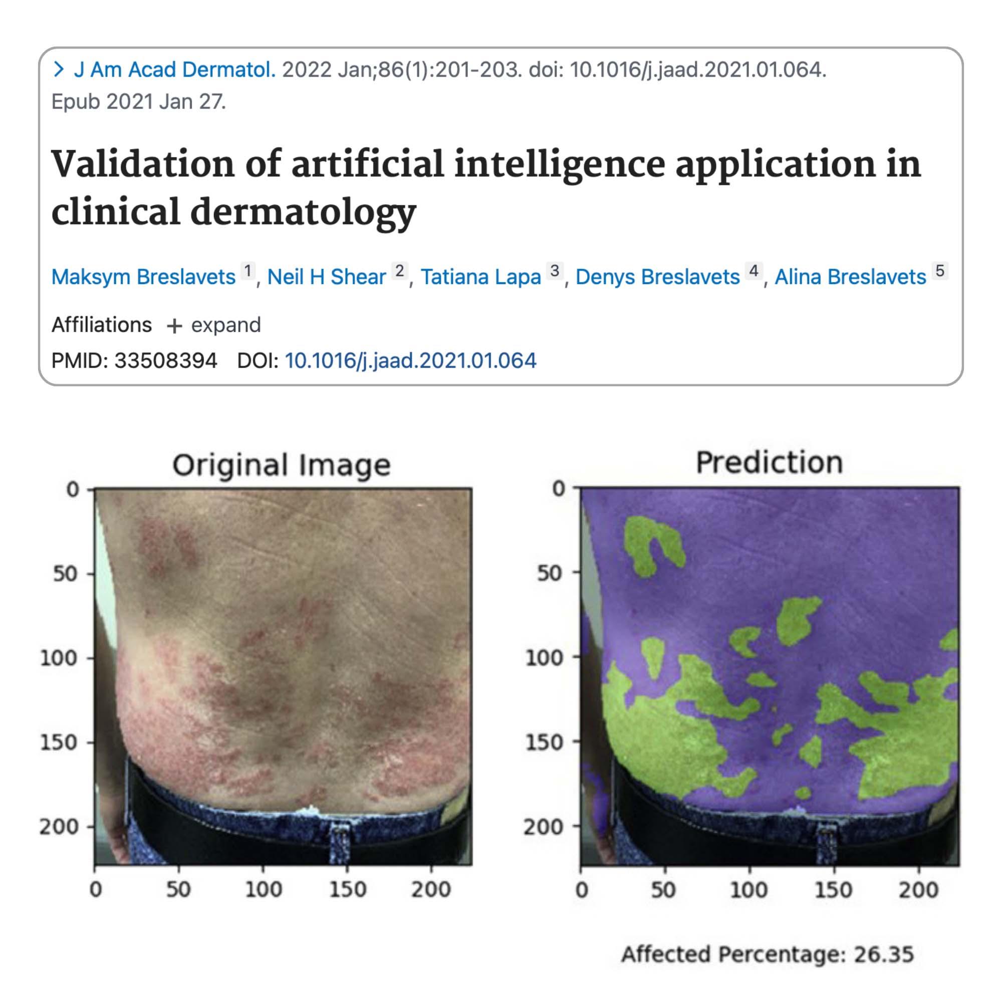 Validation of Artificial Intelligence Application in Clinical Dermatology
