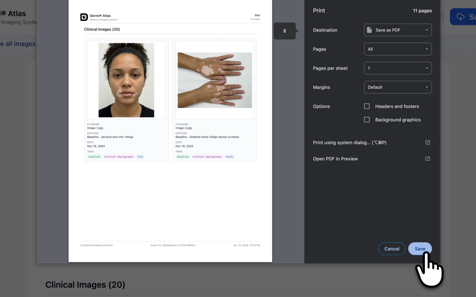 Image Pool Report preview showing the patient header, total image count, and two-column image grid