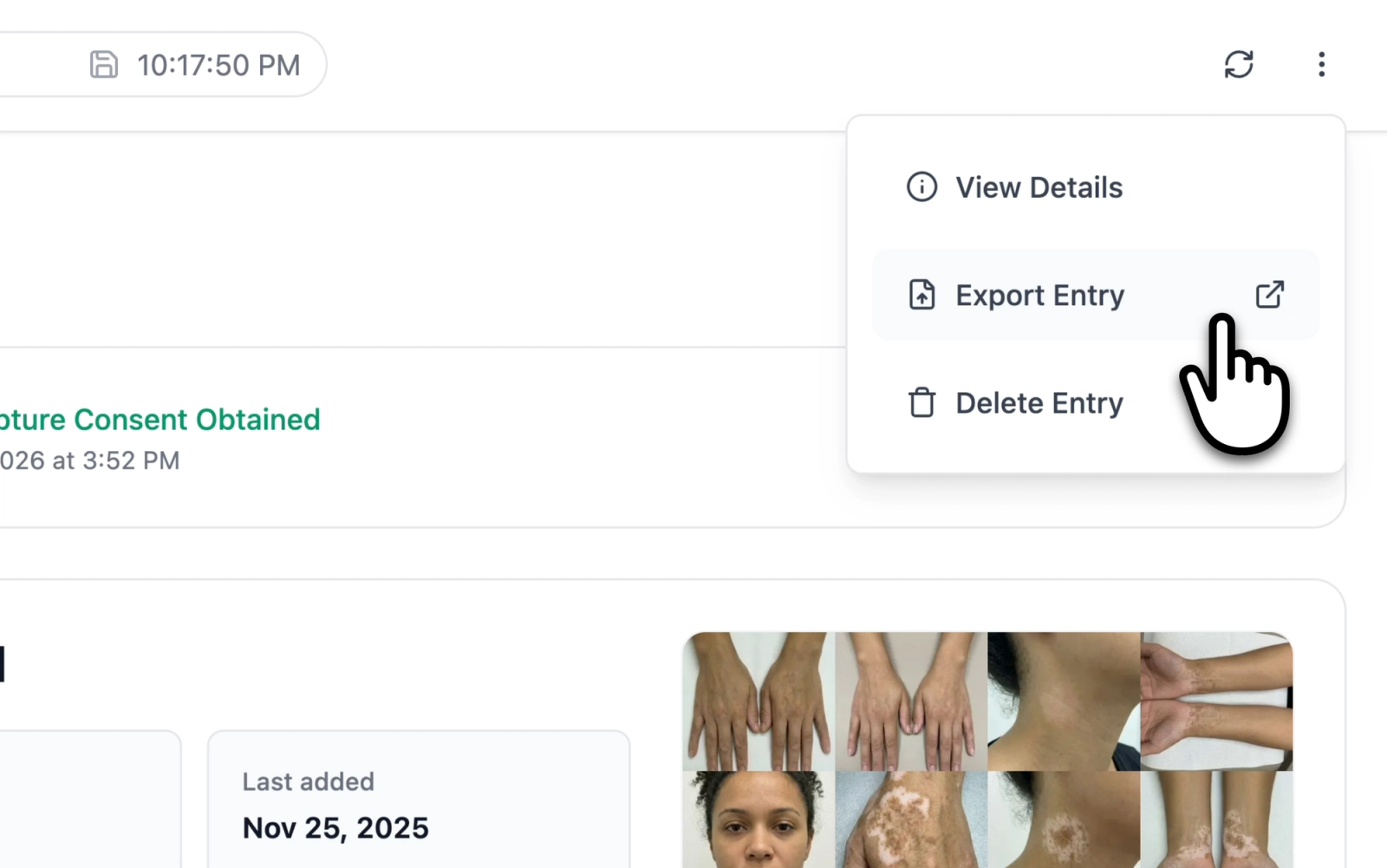 Clinical Entry page options menu showing the Export Entry action
