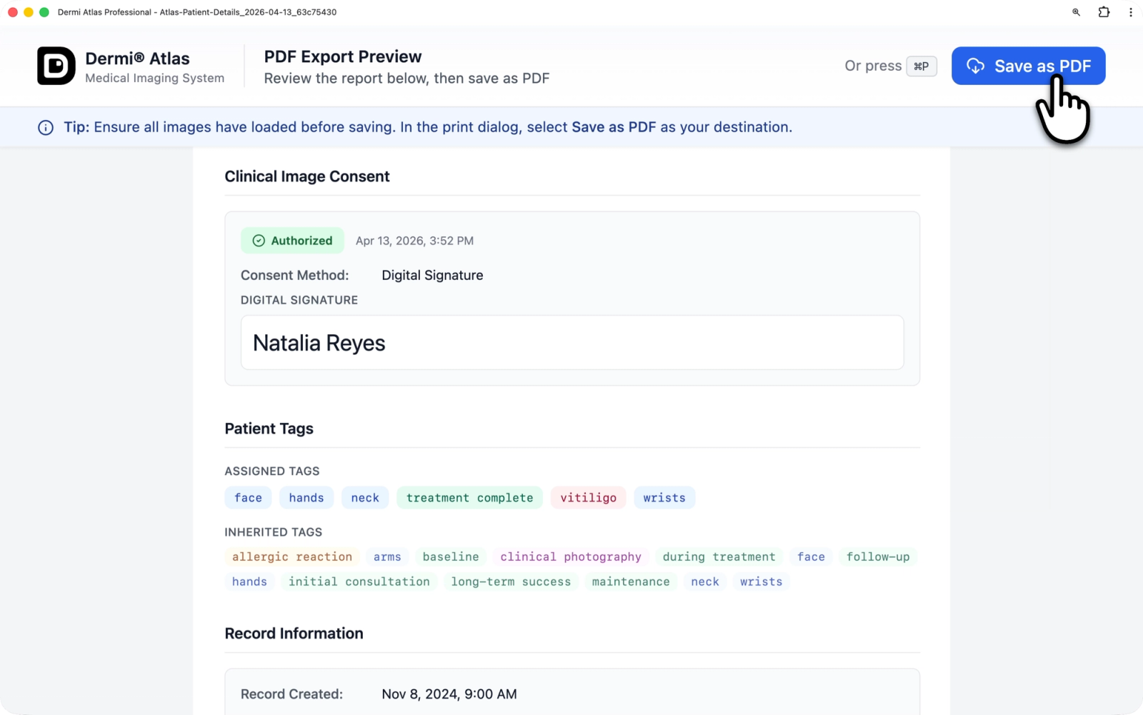 PDF Export Preview page showing the control banner with Save as PDF button, keyboard shortcut indicator, tip bar, and the beginning of report content